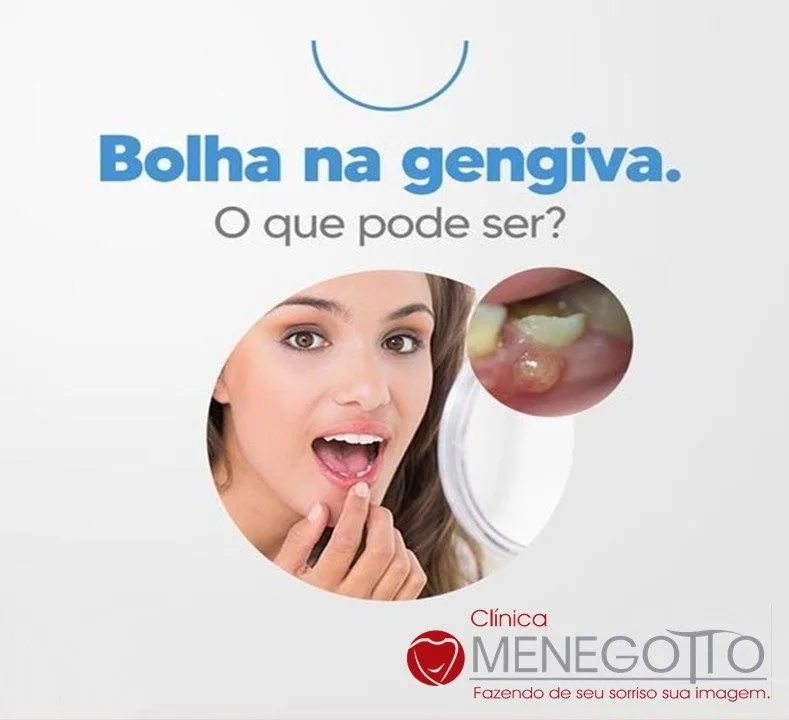 Blog 47 na Clínica Odontológica Menegotto