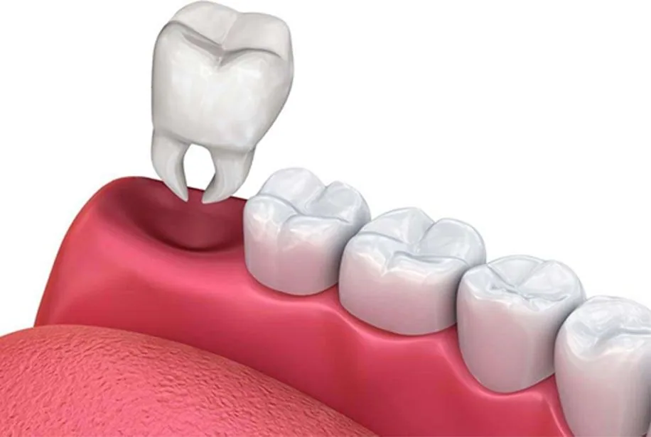 Blog 0 na Clínica Odontológica Menegotto