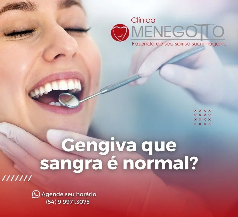Blog 35 na Clínica Odontológica Menegotto