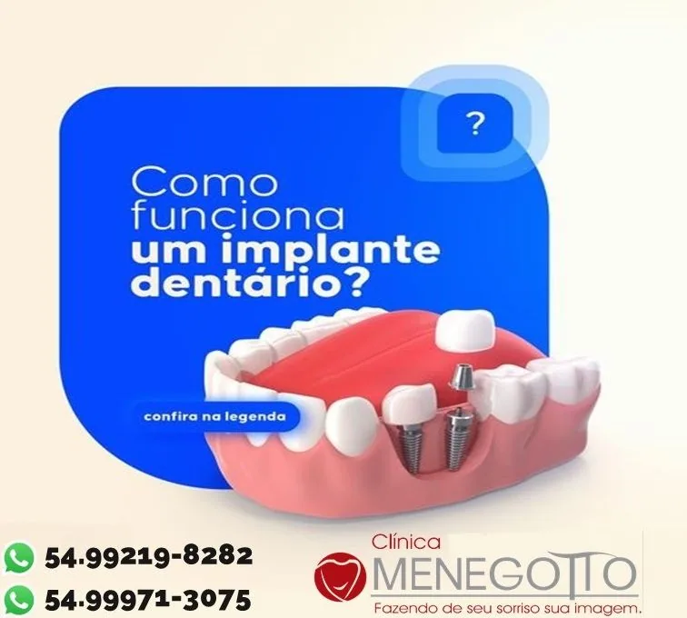 Blog 16 na Clínica Odontológica Menegotto