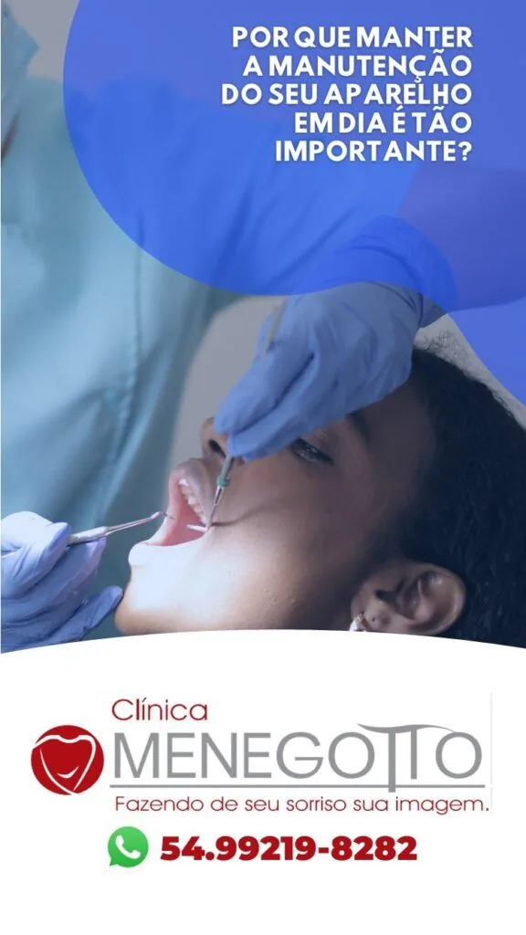 Blog 41 576x1024 na Clínica Odontológica Menegotto