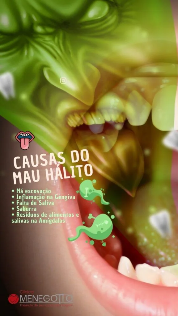 Blog 23 576x1024 na Clínica Odontológica Menegotto