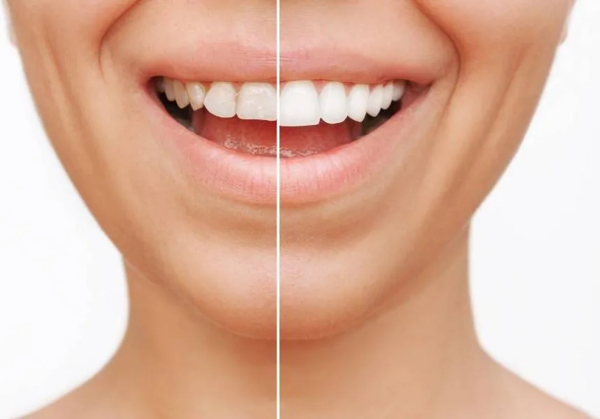 Blog 1 na Clínica Odontológica Menegotto
