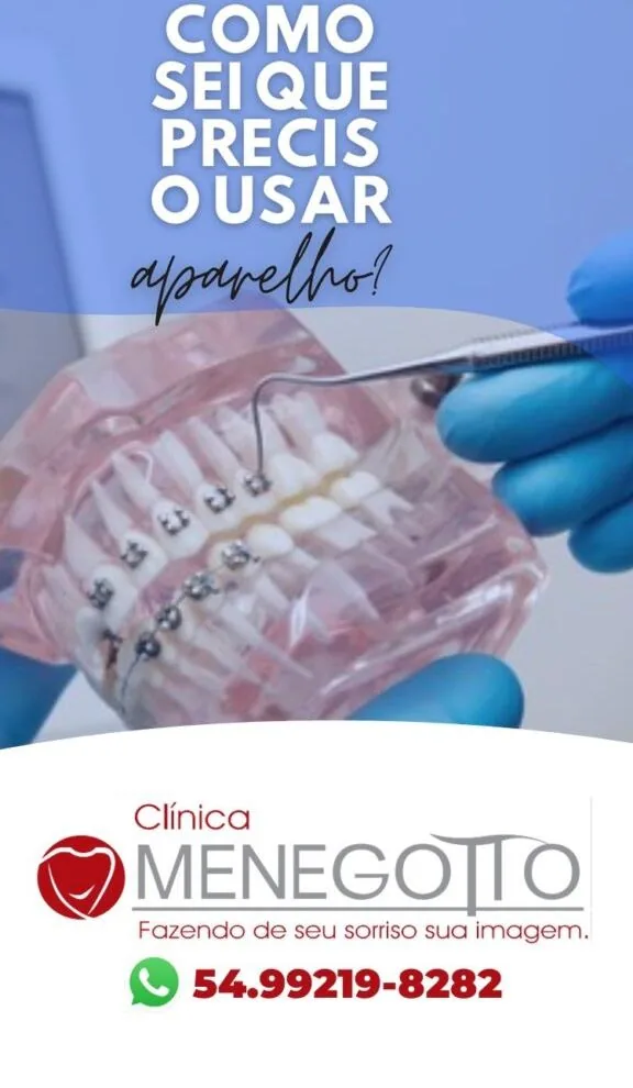 Blog 54 576x1024 na Clínica Odontológica Menegotto