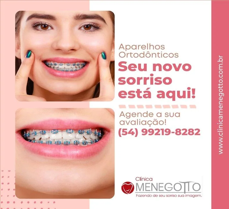 Blog 48 na Clínica Odontológica Menegotto