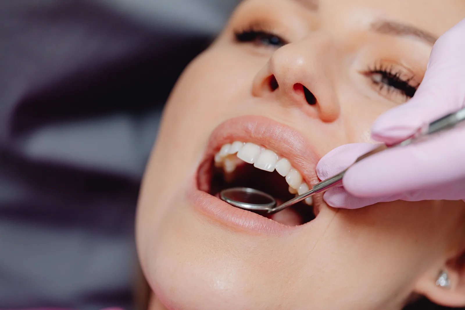 Exame odontológico em close, com espelho clínico