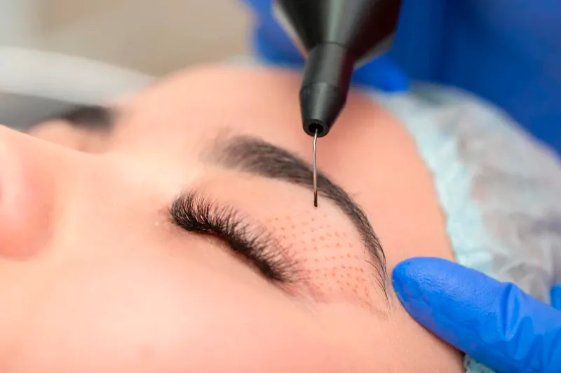 Plasma na Clínica Odontológica Menegotto