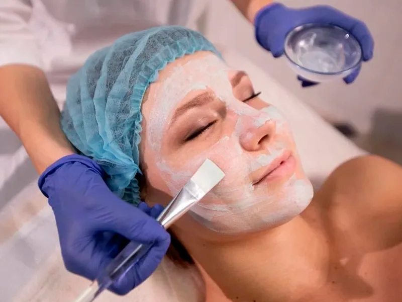 Peeling na Clínica Odontológica Menegotto