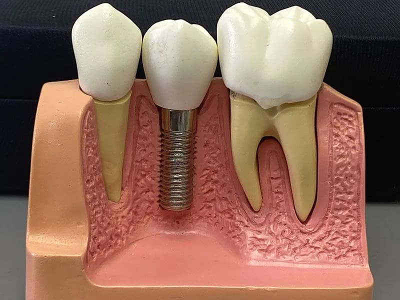 Pino clinicamenegotto na Clínica Odontológica Menegotto