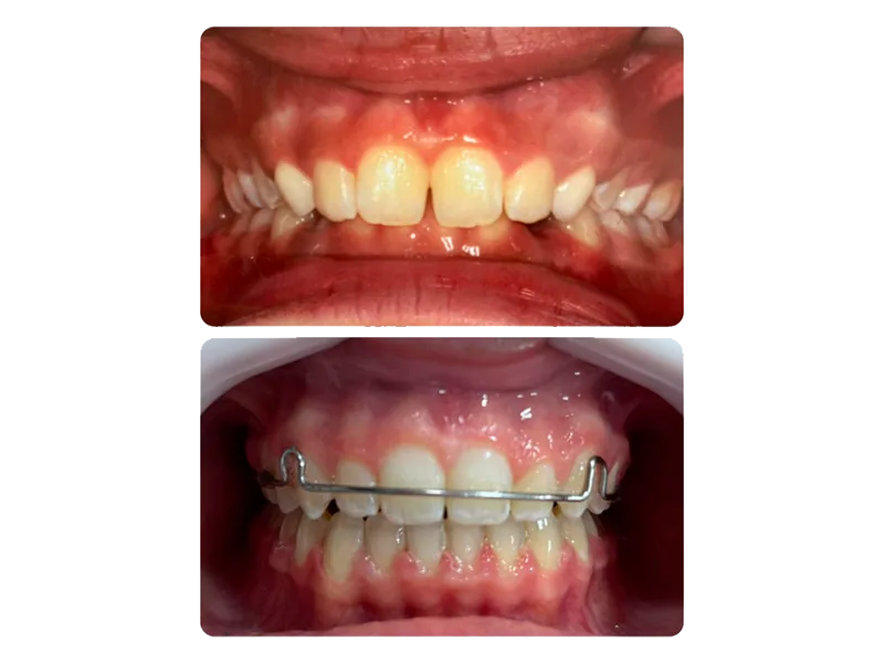 Ortodontia clinicamenegotto 01 na Clínica Odontológica Menegotto