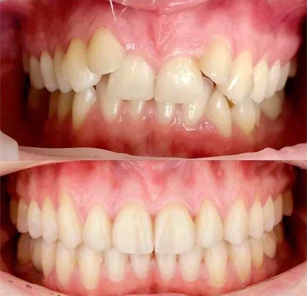 Ortodontia clinicamenegotto 03 na Clínica Odontológica Menegotto
