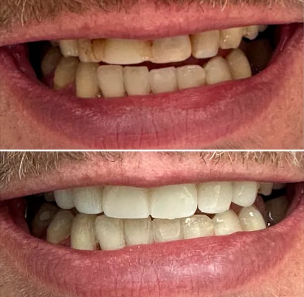 Provisorio 01 na Clínica Odontológica Menegotto