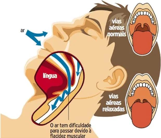 Od cl mod 0 0 na Clínica Odontológica Menegotto