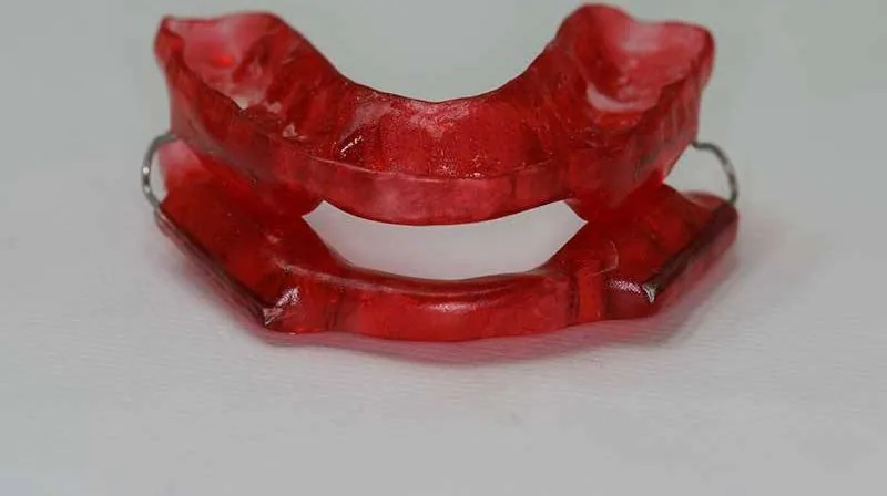 Od cl mod 0 1 na Clínica Odontológica Menegotto